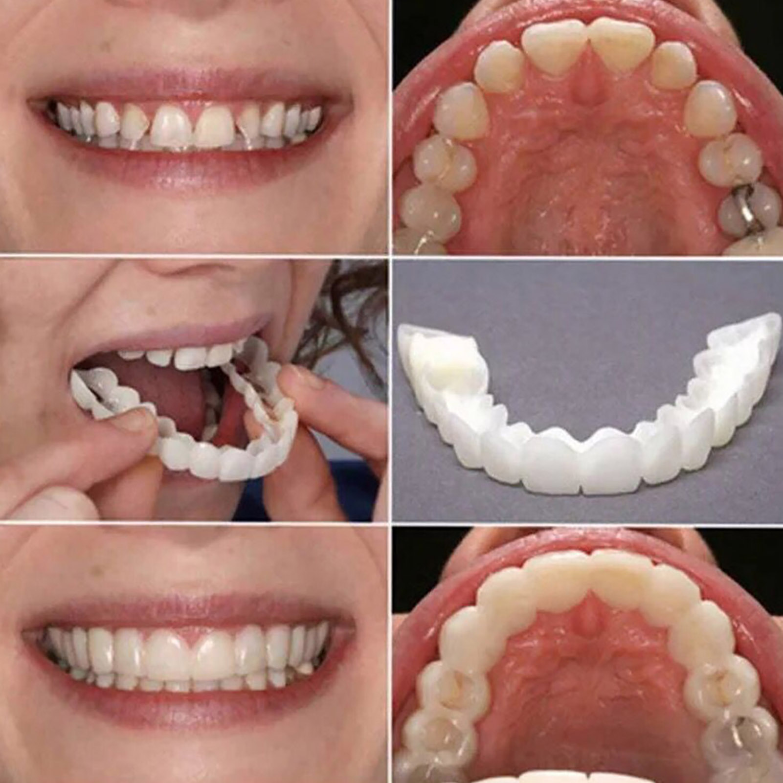 Hot Teeth Veneers Whitening De - Teeth Whitening Mask recension och pris