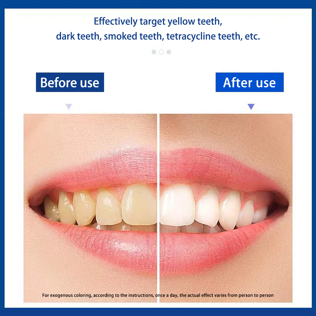 70/140 Pairs 5D White Teeth Wh - Teeth Whitening Effects recension och pris