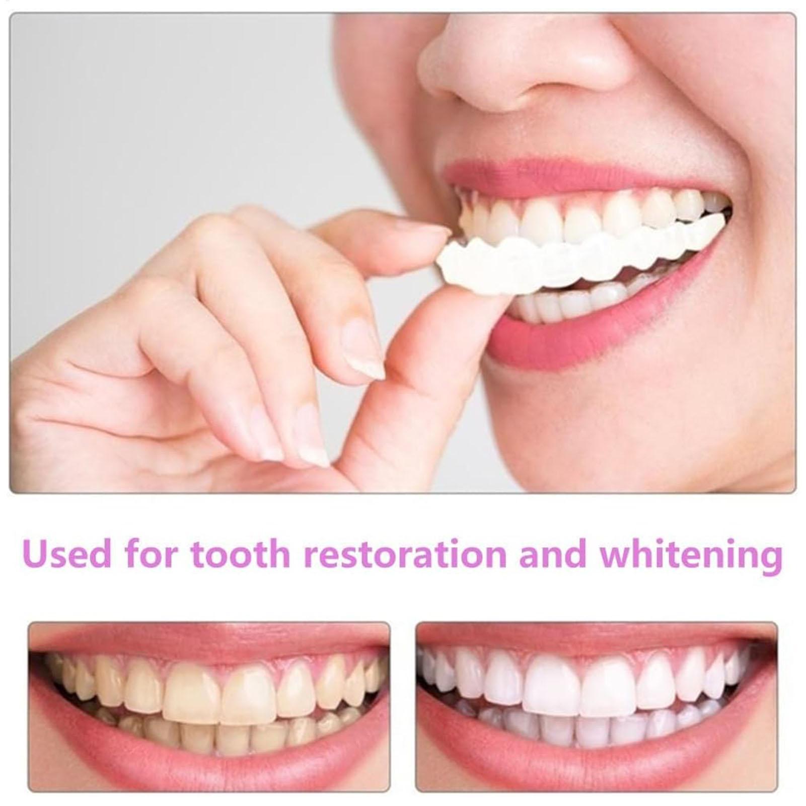 2pcs Men Women Temporary Teeth - Teeth Whitening Mask recension och pris